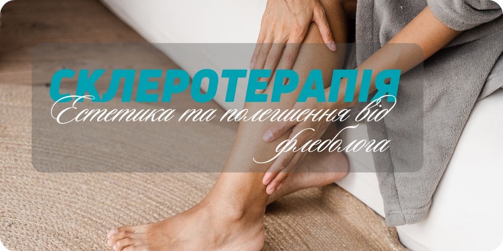 Склеротерапія вен: естетика та полегшення від флеболога