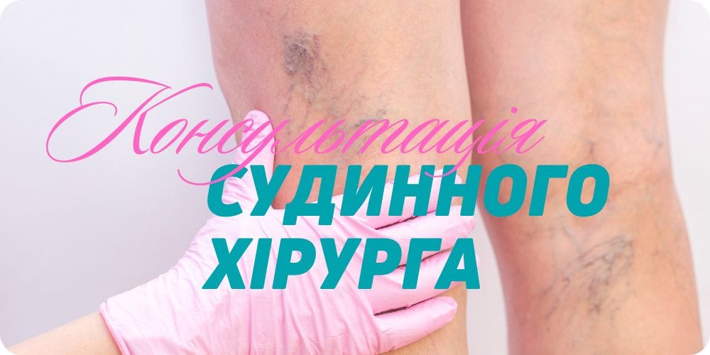 Консультація судинного хірурга