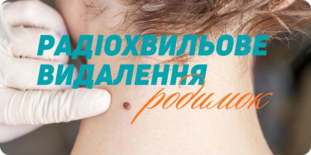 Радіохвильове видалення родимок та новоутворень