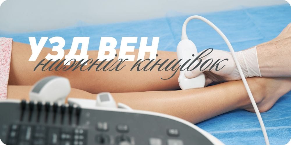 УЗД вен нижніх кінцівок