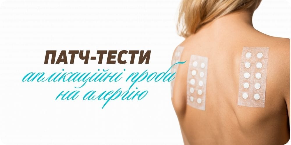Патч-тести (аплікаційні проби)